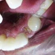 Dental Implant